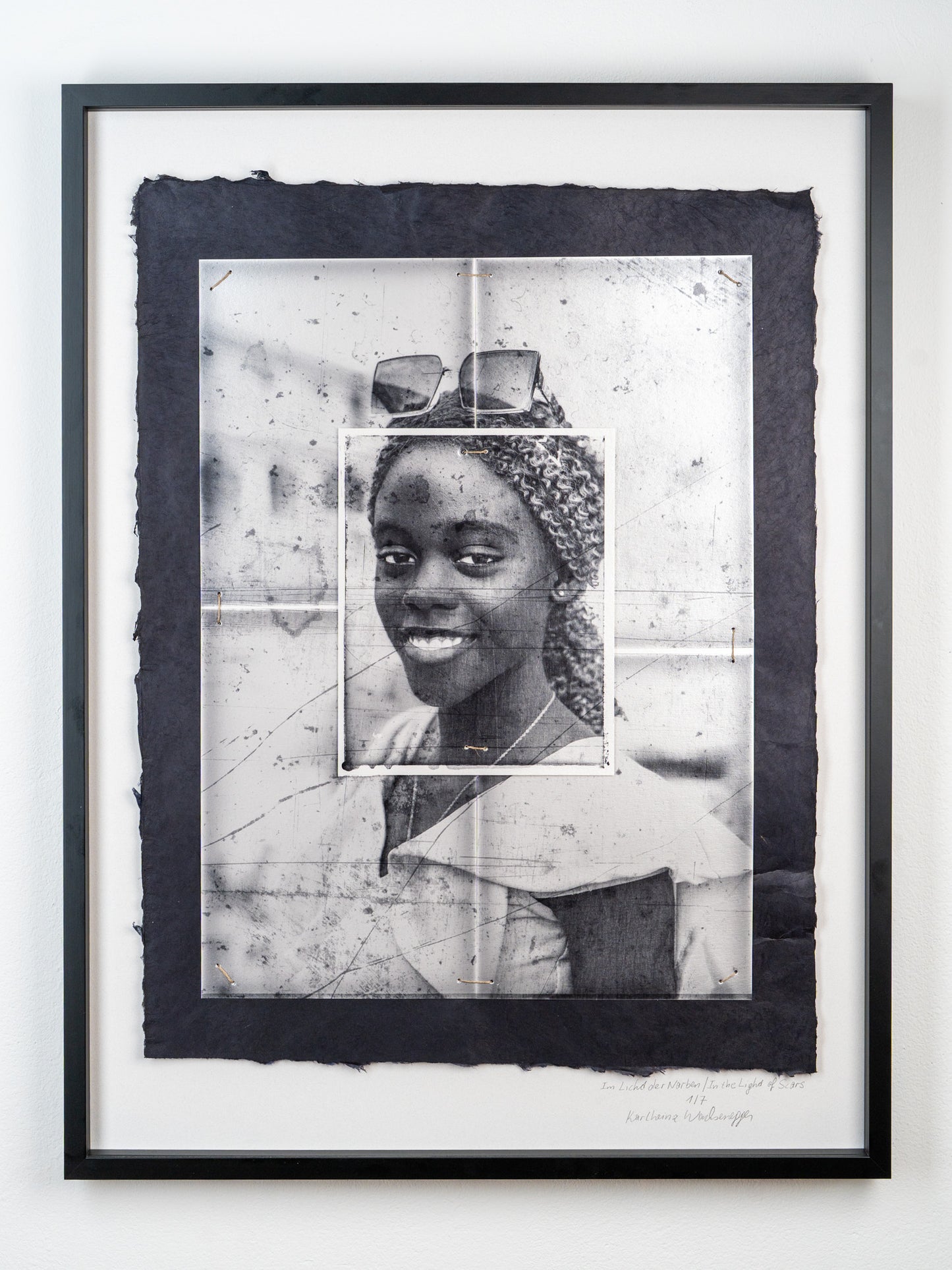 In the Light of Scars